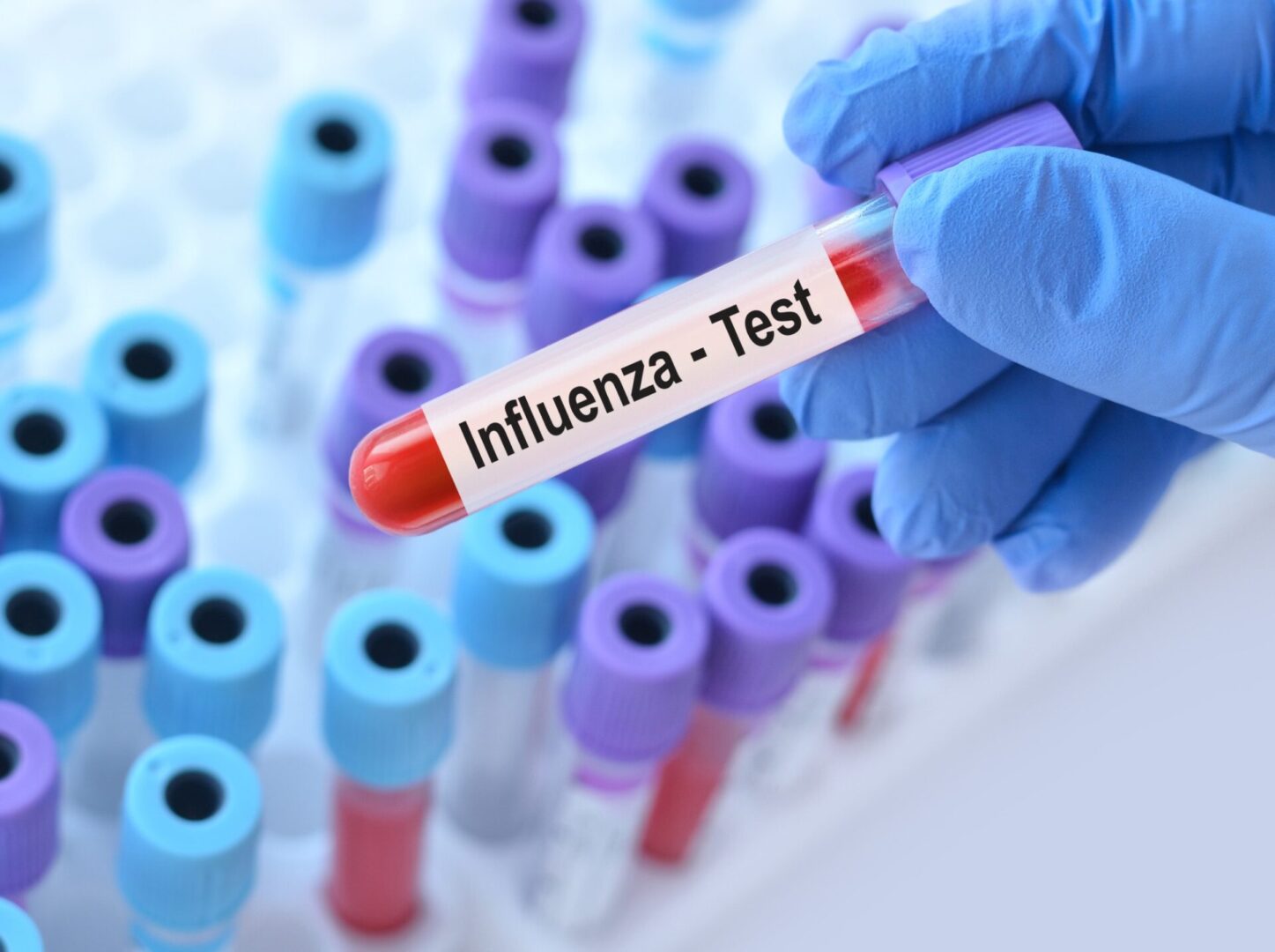 Gloved hand holding influenza test tube.