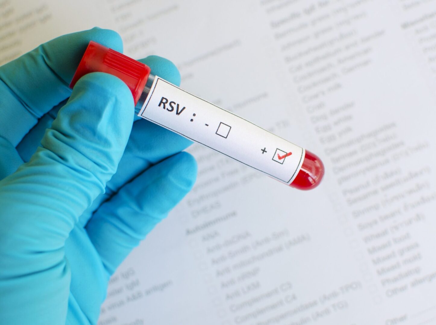Gloved hand holding RSV test tube.