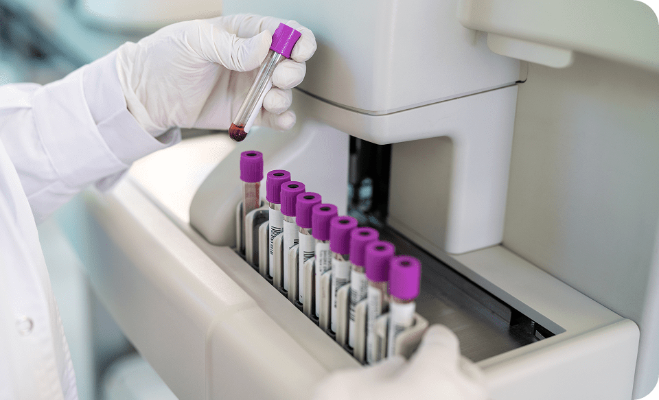Lab technician handling blood samples with a machine.